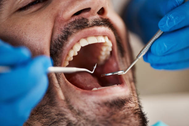 Best Emergency Dental Care for Trauma or Injury in Hayfield, VA